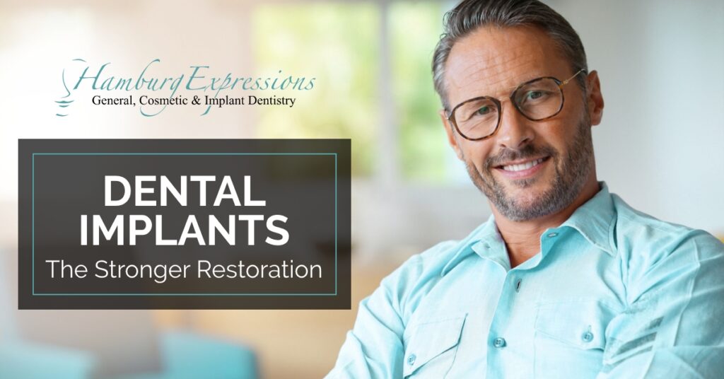 Dental Implants in Lexington, KY